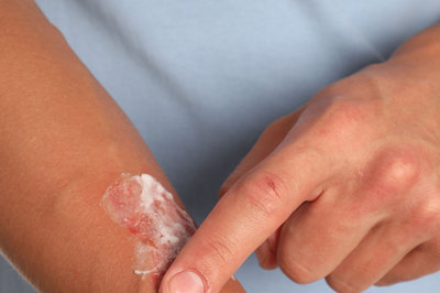 Bepanthol Krem Kullananlar ve Kullanıcı Yorumları | 2026 Rehberi